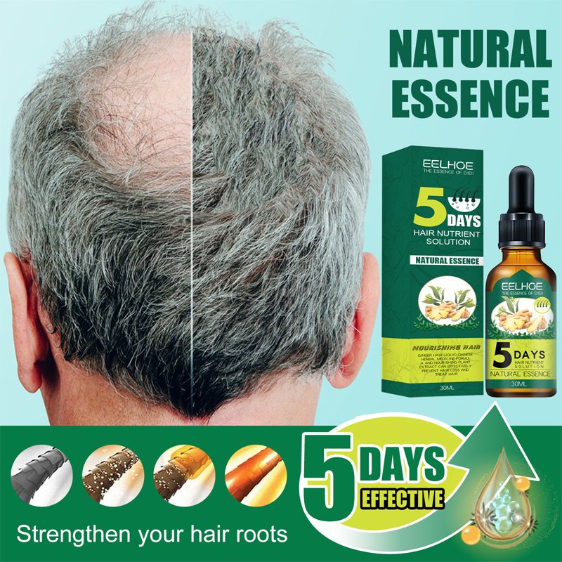 5 Days Ginger Hair Growth Products Natural Anti Hair Loss Prevent Baldness Treatment Fast Growing Nourish Dry Damaged Hair Care 5 Days Ginger Hair Growth Products Natural Anti Hair Loss Prevent Baldness Treatment Fast Growing Nourish Dry Damaged Hair Care