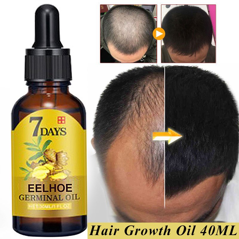 Ginger Essential Hair Growth Oil Liquid Anti Hair Loss Baldness Remedy Boost Grow Thicker Hair Care Scalp Treatment 40ml Ginger Essential Hair Growth Oil Liquid Anti Hair Loss Baldness Remedy Boost Grow Thicker Hair Care Scalp Treatment 40ml