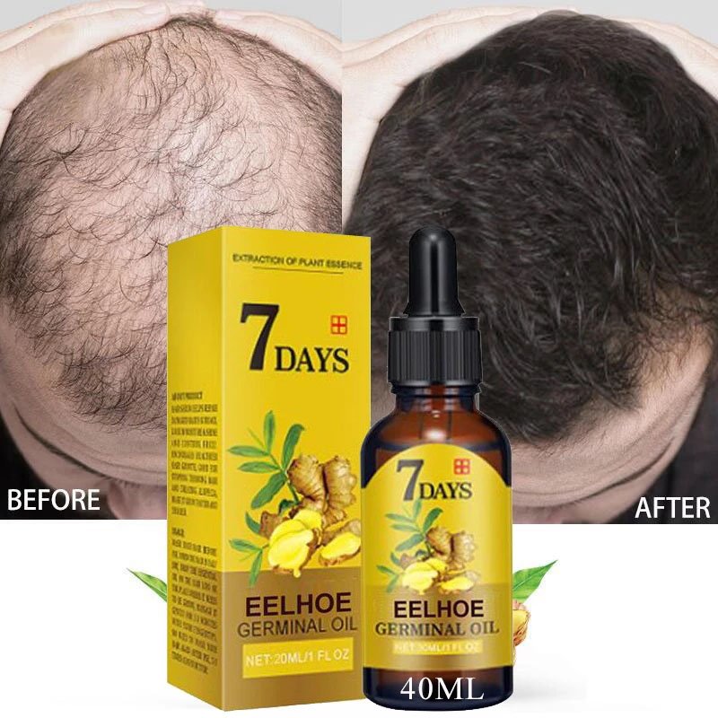 Ginger Essential Hair Growth Oil Liquid Anti Hair Loss Baldness Remedy Boost Grow Thicker Hair Care Scalp Treatment 40ml Ginger Essential Hair Growth Oil Liquid Anti Hair Loss Baldness Remedy Boost Grow Thicker Hair Care Scalp Treatment 40ml