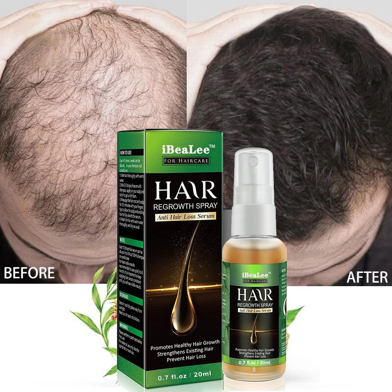 Ginger Hair Growth Products Fast Growing Hair Essential Oil Beauty Hair Care Prevent Hair Loss Oil Scalp Treatment For Men Women Ginger Hair Growth Products Fast Growing Hair Essential Oil Beauty Hair Care Prevent Hair Loss Oil Scalp Treatment For Men Women