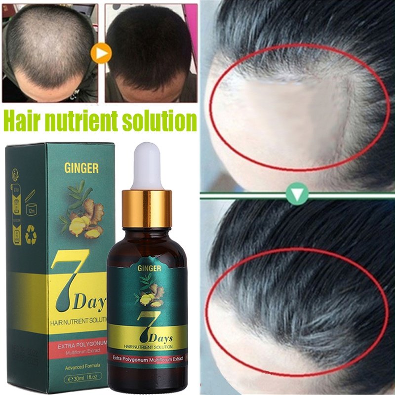 10/15/20/40ml Fast Hair Regrowth Essential Oil 7 Days Anti-loss Strong the Root of Hair Serum Ginger Hair Loss Treatment 10/15/20/40ml Fast Hair Regrowth Essential Oil 7 Days Anti-loss Strong the Root of Hair Serum Ginger Hair Loss Treatment