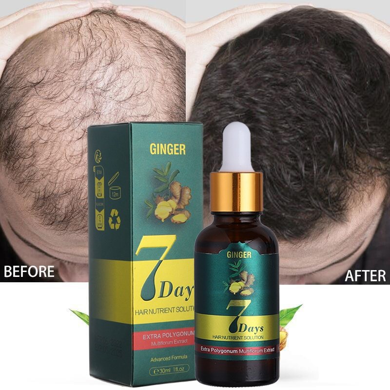 10/15/20/40ml Fast Hair Regrowth Essential Oil 7 Days Anti-loss Strong the Root of Hair Serum Ginger Hair Loss Treatment 10/15/20/40ml Fast Hair Regrowth Essential Oil 7 Days Anti-loss Strong the Root of Hair Serum Ginger Hair Loss Treatment