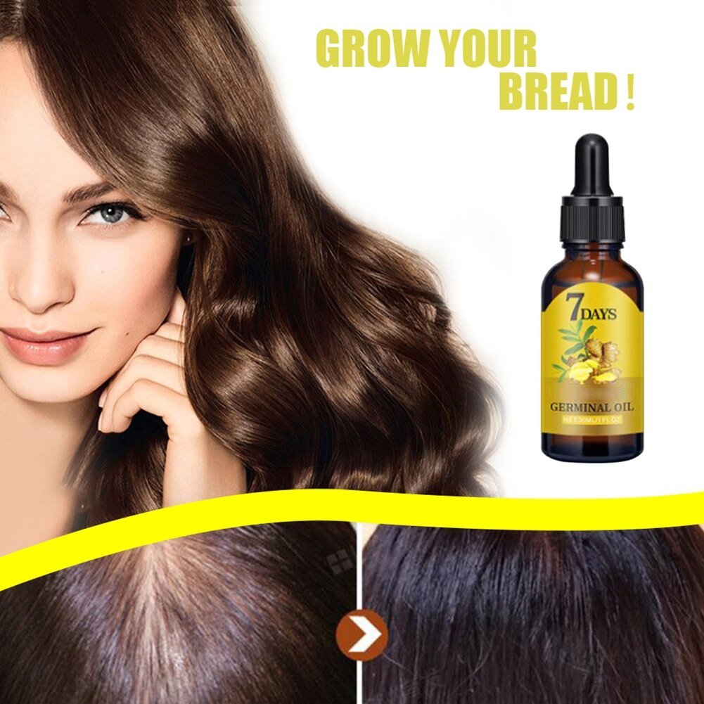 10/15/20/40ml Fast Hair Regrowth Essential Oil 7 Days Anti-loss Strong the Root of Hair Serum Ginger Hair Loss Treatment 10/15/20/40ml Fast Hair Regrowth Essential Oil 7 Days Anti-loss Strong the Root of Hair Serum Ginger Hair Loss Treatment