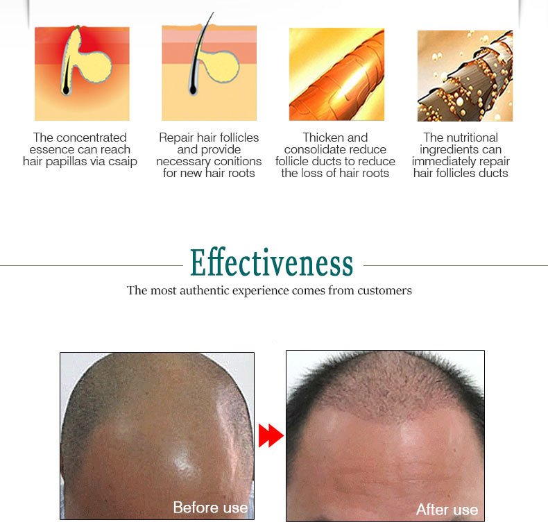 Ginger Hair Growth Essence Oils Products Anti Hair Loss Treatement Fast Growing Germinal Serum Prevent Scalp Damaged Men Women