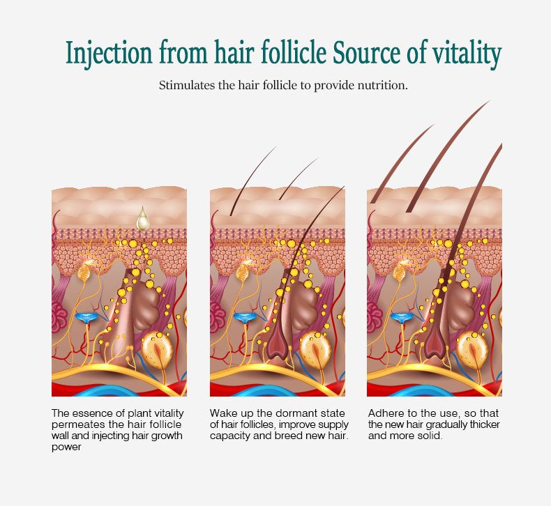 Ginger Hair Growth Essence Oils Products Anti Hair Loss Treatement Fast Growing Germinal Serum Prevent Scalp Damaged Men Women