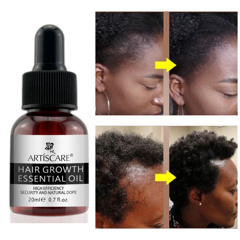 Ginger Hair Growth Essence Oils Products Anti Hair Loss Treatement Fast Growing Germinal Serum Prevent Scalp Damaged Men Women Ginger Hair Growth Essence Oils Products Anti Hair Loss Treatement Fast Growing Germinal Serum Prevent Scalp Damaged Men Women