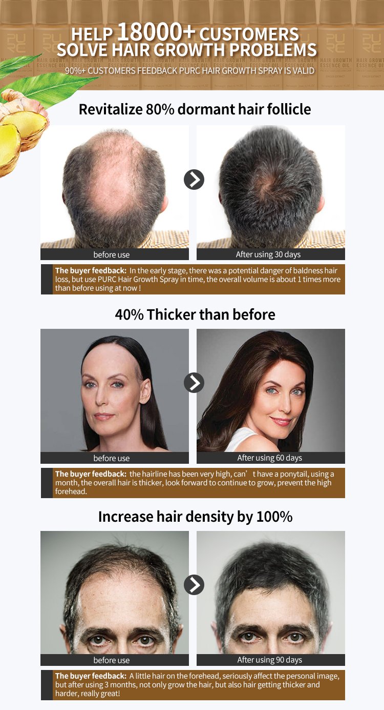 Hair Growth Products Ginger Essence Fast Regrowth Serum Beard Growth Oil Hair Loss Care Beauty Scalp Treatment For Men Women Hair Growth Products Ginger Essence Fast Regrowth Serum Beard Growth Oil Hair Loss Care Beauty Scalp Treatment For Men Women