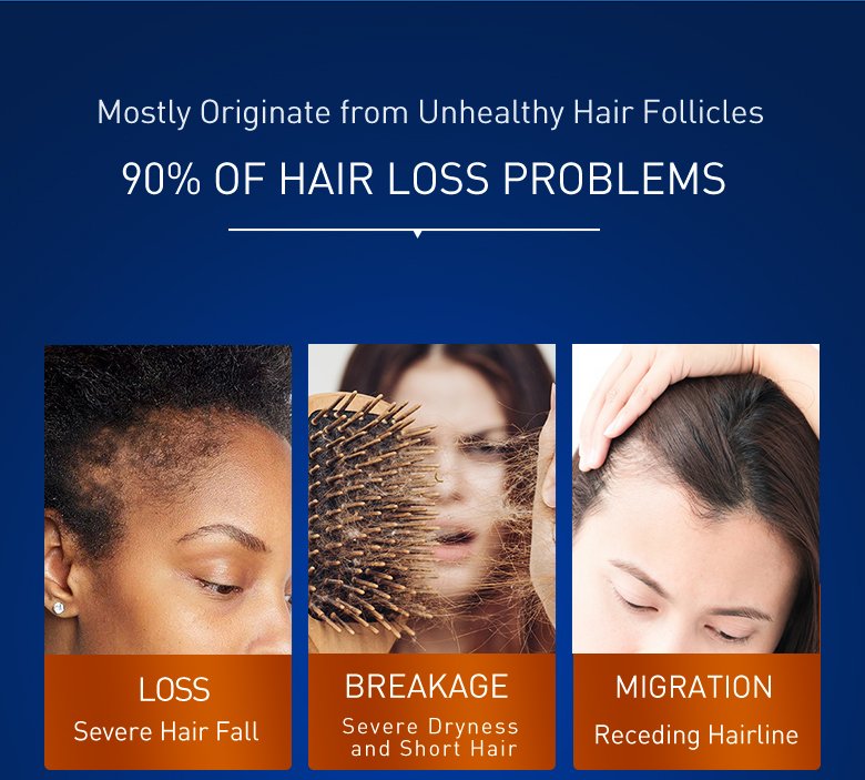 PURC Hair Growth Products Biotin Fast Grow Hair Oil Beard Growth Oil Anti Hair Loss Sprays For Men Women Beauty Health Care 30ML PURC Hair Growth Products Biotin Fast Grow Hair Oil Beard Growth Oil Anti Hair Loss Sprays For Men Women Beauty Health Care 30ML