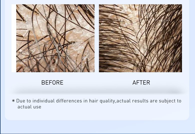 PURC Hair Growth Products Biotin Fast Grow Hair Oil Beard Growth Oil Anti Hair Loss Sprays For Men Women Beauty Health Care 30ML PURC Hair Growth Products Biotin Fast Grow Hair Oil Beard Growth Oil Anti Hair Loss Sprays For Men Women Beauty Health Care 30ML