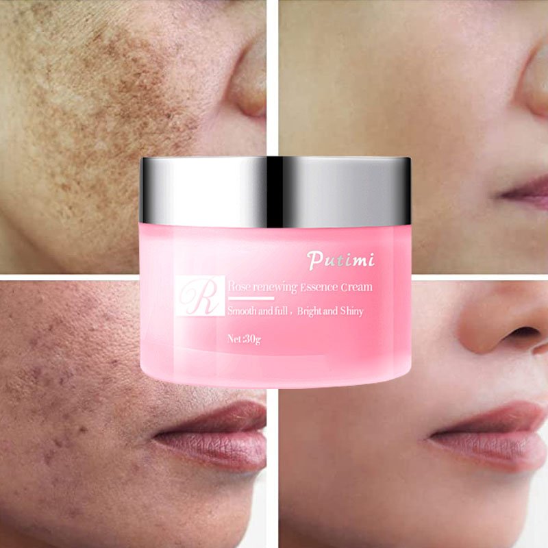Effective Whitening Cream Freckle Cream Remove Dark Spots Fade Acne Scars Melanin Pigmentation Melasma Anti-Aging Brighten Skin Effective Whitening Cream Freckle Cream Remove Dark Spots Fade Acne Scars Melanin Pigmentation Melasma Anti-Aging Brighten Skin