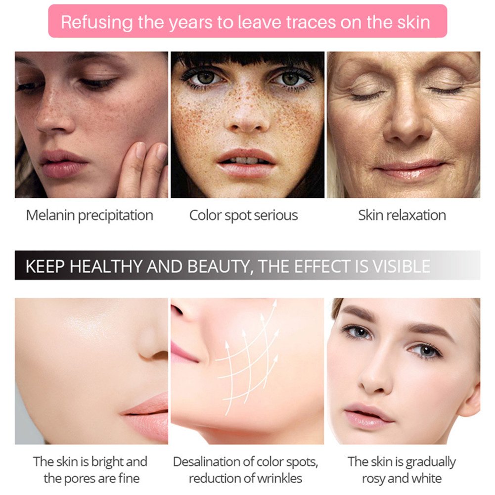 Effective Whitening Cream Freckle Cream Remove Dark Spots Fade Acne Scars Melanin Pigmentation Melasma Anti-Aging Brighten Skin Effective Whitening Cream Freckle Cream Remove Dark Spots Fade Acne Scars Melanin Pigmentation Melasma Anti-Aging Brighten Skin