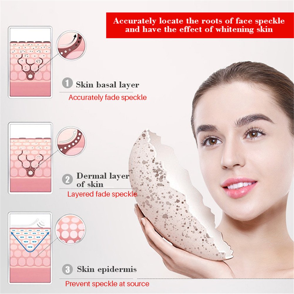 Effective Whitening Cream Freckle Cream Remove Dark Spots Fade Acne Scars Melanin Pigmentation Melasma Anti-Aging Brighten Skin Effective Whitening Cream Freckle Cream Remove Dark Spots Fade Acne Scars Melanin Pigmentation Melasma Anti-Aging Brighten Skin