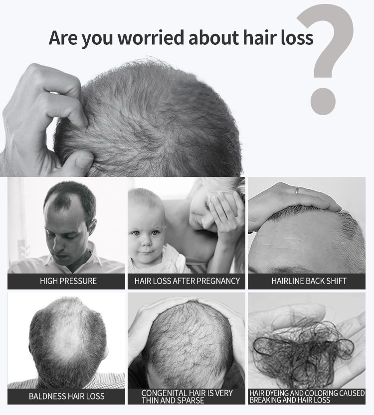 Hair Care Hair Growth Essential Oils Essence Original Authentic 100% Hair Loss Liquid Health Care Beauty Dense Hair Growth Serum Hair Care Hair Growth Essential Oils Essence Original Authentic 100% Hair Loss Liquid Health Care Beauty Dense Hair Growth Serum