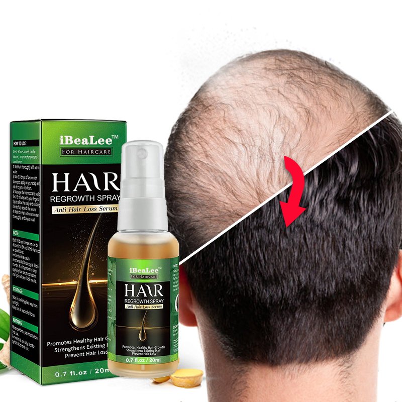 Hair Care Hair Growth Essential Oils Essence Original Authentic 100% Hair Loss Liquid Health Care Beauty Dense Hair Growth Serum Hair Care Hair Growth Essential Oils Essence Original Authentic 100% Hair Loss Liquid Health Care Beauty Dense Hair Growth Serum