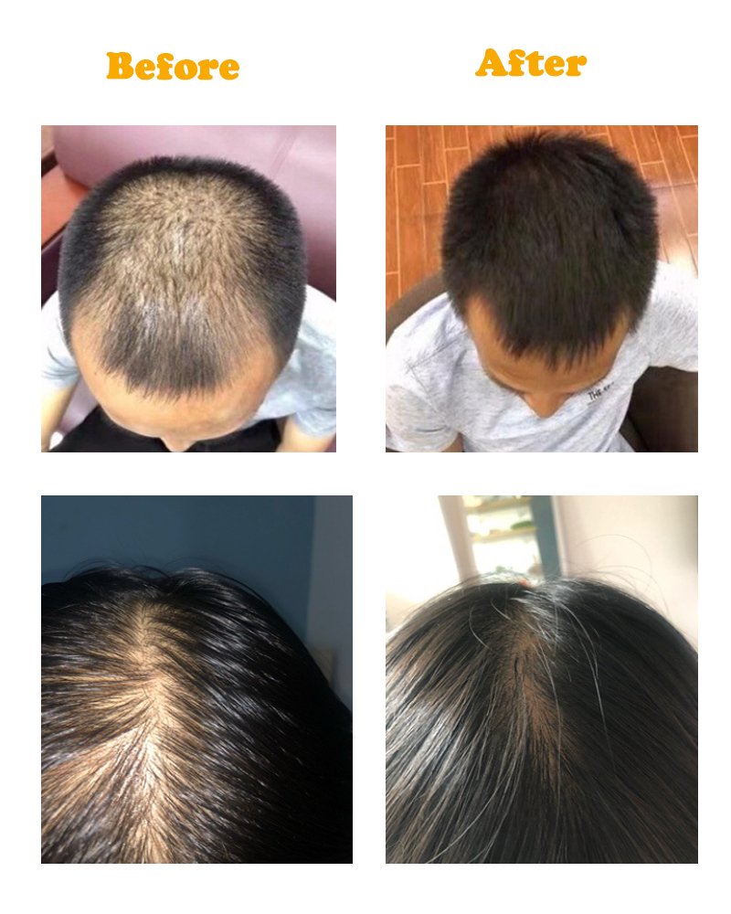 Hair Care Hair Growth Essential Oils Essence Original Authentic 100% Hair Loss Liquid Health Care Beauty Dense Hair Growth Serum Hair Care Hair Growth Essential Oils Essence Original Authentic 100% Hair Loss Liquid Health Care Beauty Dense Hair Growth Serum